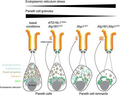 The Selective Autophagy Receptor Optineurin in Crohn’s Disease